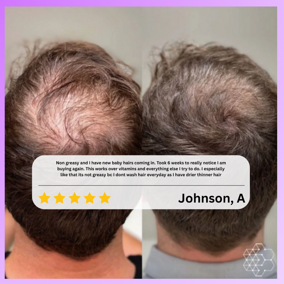 MOVI. Hair Growth Oil