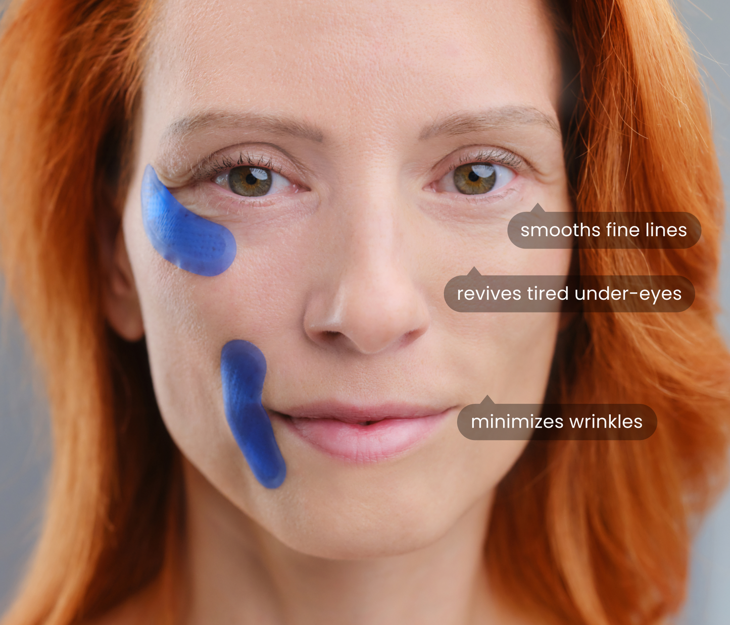 MOVI. Micro-Infusion Patches