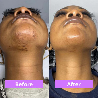 MOVI. Cyperus Rotundus Oil