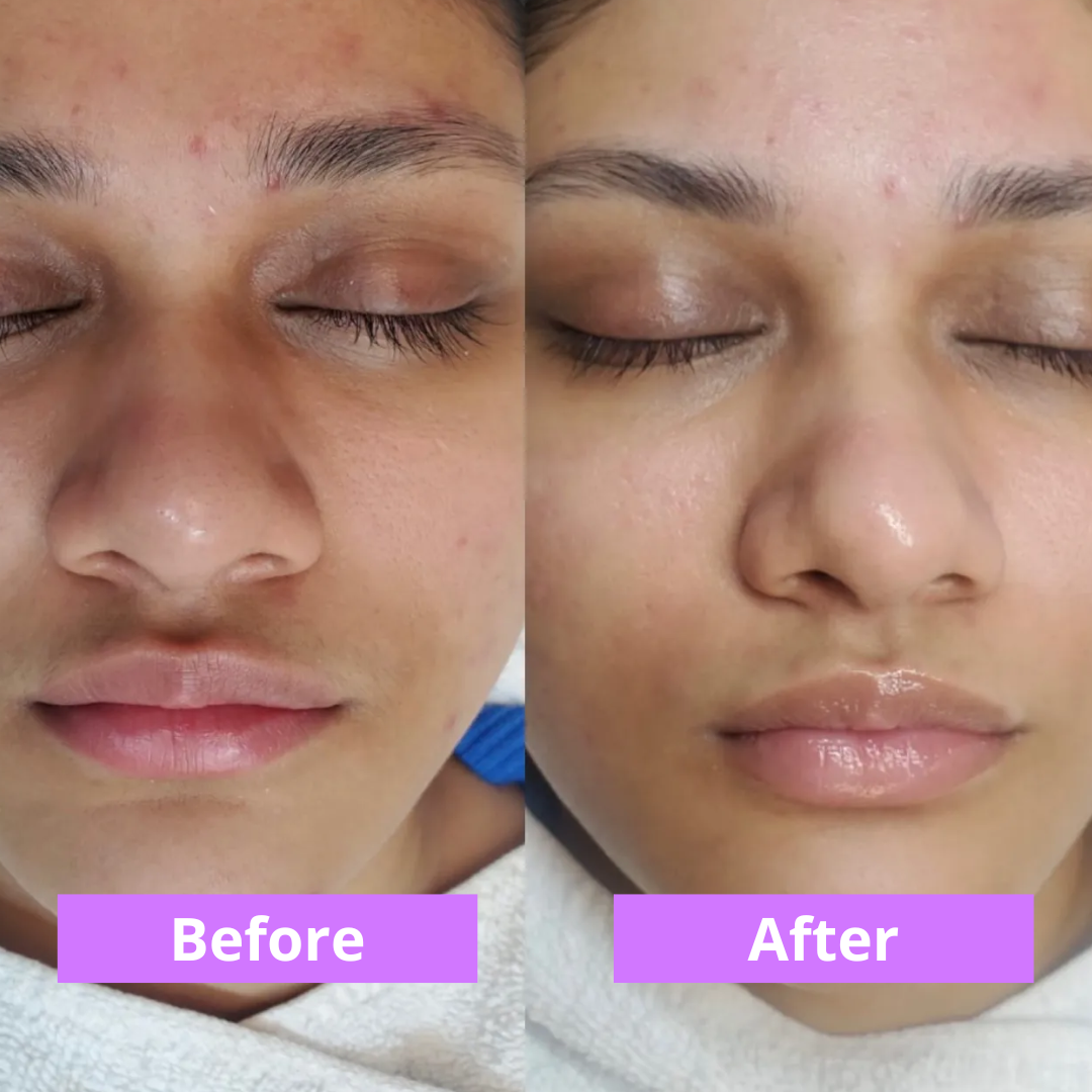 MOVI. Cyperus Rotundus Oil