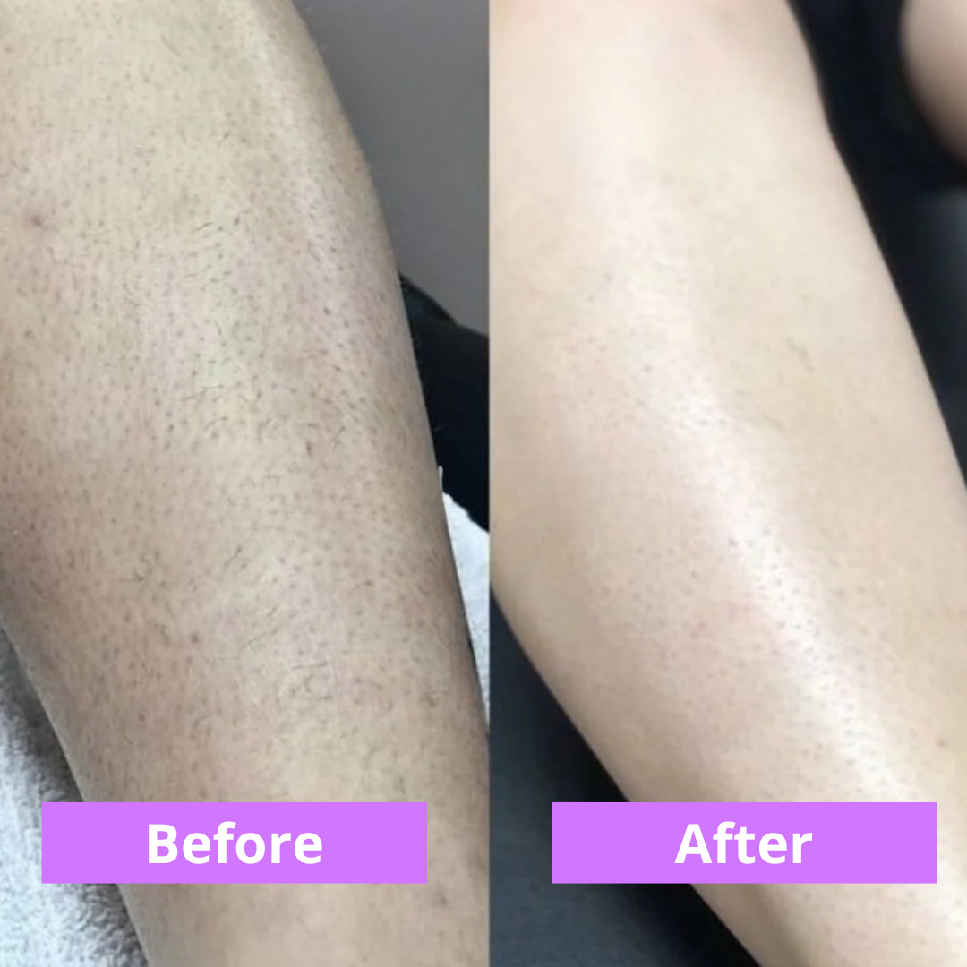 MOVI. Cyperus Rotundus Oil