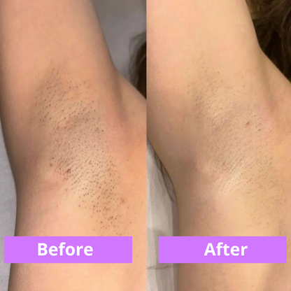 MOVI. Cyperus Rotundus Oil