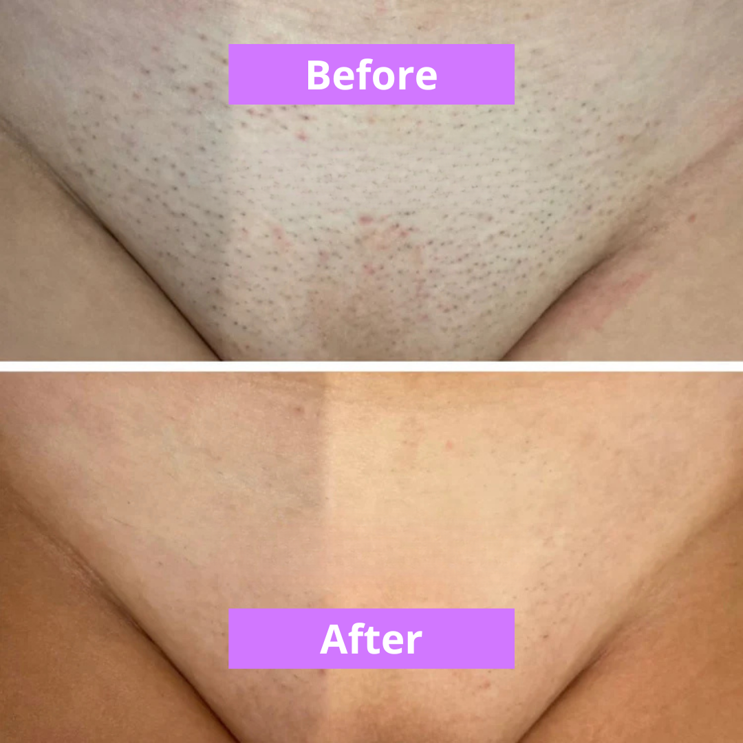 MOVI. Cyperus Rotundus Oil