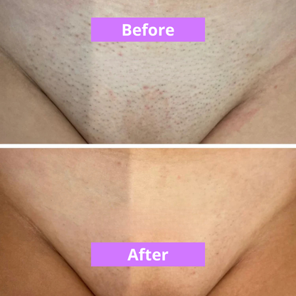 MOVI. Cyperus Rotundus Oil