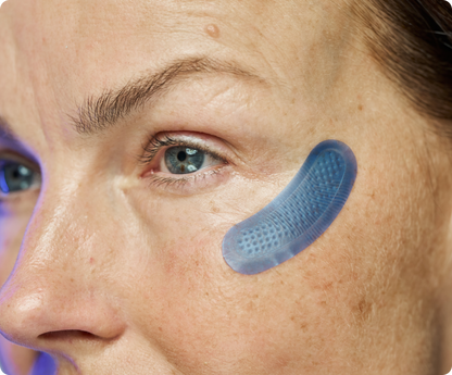 MOVI. Micro-Infusion Patches