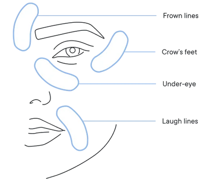 MOVI. Micro-Infusion Patches